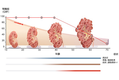 70歳までに約半数が末期腎不全に至るとされます