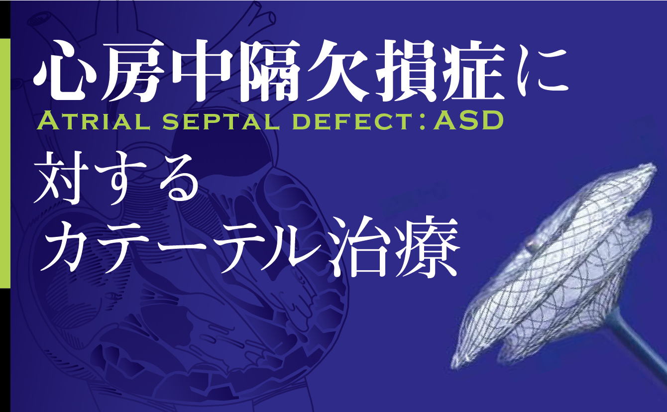 心房中隔欠損症のカテーテル治療