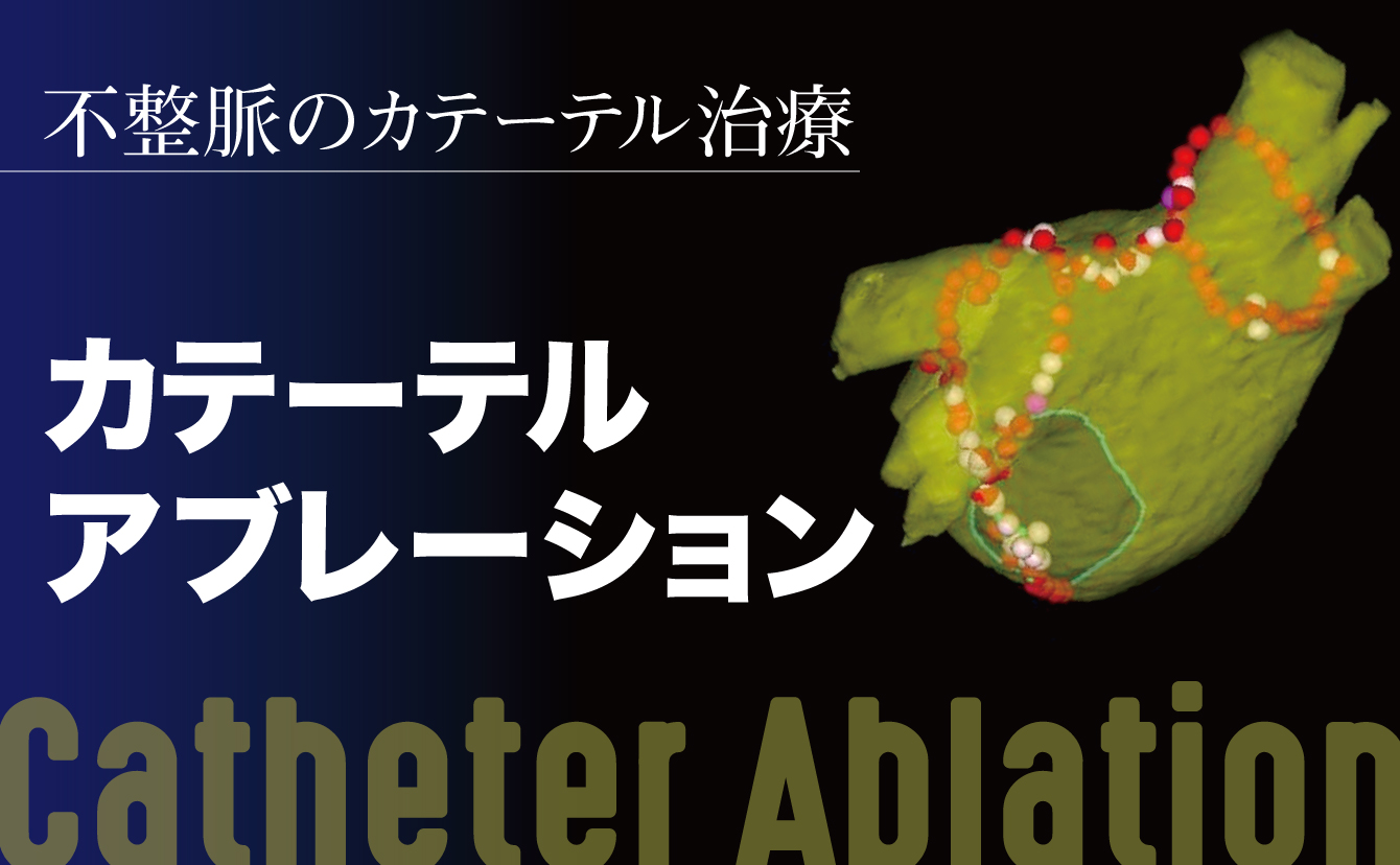 頻脈性不整脈に対するカテーテルアブレーション