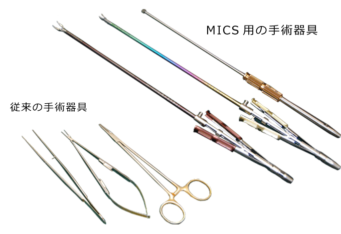 従来の手術器具と、MICSの手術器具の比較図。MICS手術には専用の細長い器具を使います。