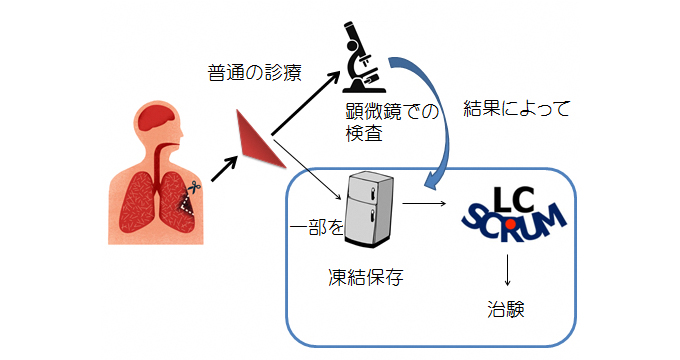 LC-SCRUMの検査手順の図解の画像